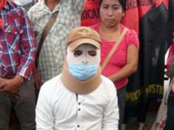 Señaló que continuará con los tratamientos médicos y cuidados especiales para continuar su proceso de recuperación. SUN / O. Gutiérrez