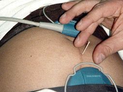 Ahora la placenta es la pieza central de un nuevo campo de investigación biológica que relaciona cómo los genes y el medio interactúan para alterar la trayectoria del desarrollo del cerebro humano. NTX / ARCHIVO