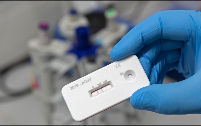 En Jalisco se realizan mil 500 pruebas diarias (entre rápidas y PCR). AP /ARCHIVO