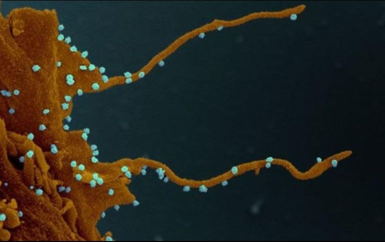 La célula infectada, siguiendo las instucciones del virus (en azul), desarrolla largos tentáculos para infectar otras células. ELIZABETH FISCHER, MICROSCOPY UNIT NIH/NIAID
