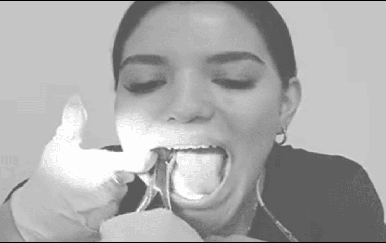 La mujer, identificada como Ana Victoria en su cuenta de Twitter, compartió el video a través de dicha plataforma en el que se le puede ver aplicarse la anestesia con una jeringa, gracias a la ayuda de un espejo. ESPECIAL / TWITTER