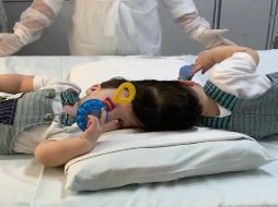 Arthur y Bernardo Lima ueron los gemelos más grandes de edad que lograron ser separados. ESPECIAL