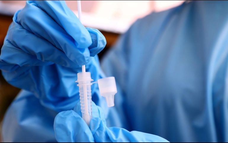 El Western New York Urology Associates indica que la meningitis se caracteriza por la inflamación del recubrimiento del cerebro (llamado meninges). AFP / ARCHIVO