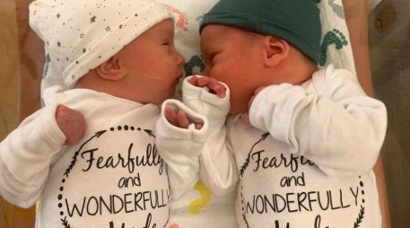 Lydia Ann y Timothy Ronald Ridgeway nacieron el 31 de octubre de 2022. EPA