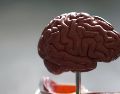 Los golpes reiterados en la cabeza podrían provocar trastornos cerebrales. ESPECIAL/UNSPLASH