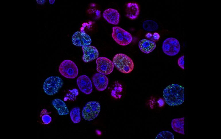 La presencia y forma de expresión de la HAPLN1 podría usarse para identificar a quienes necesitan un seguimiento más exhaustivo o incluso tratamientos diferenciados, según los expertos. ESPECIAL/Unsplash