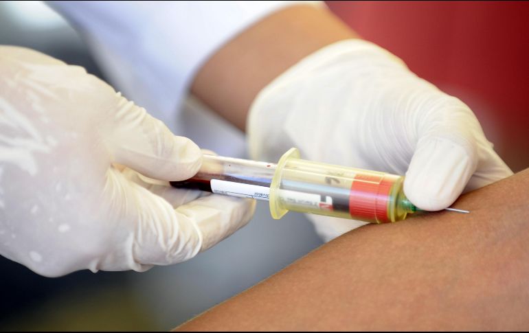 El estigma social en torno al VIH impide que las personas conozcan su diagnóstico, pues por miedo, no se someten a las pruebas para su detección. EFE / ARCHIVO