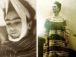 La causa de la muerte de Frida Kahlo fue oficialmente una 