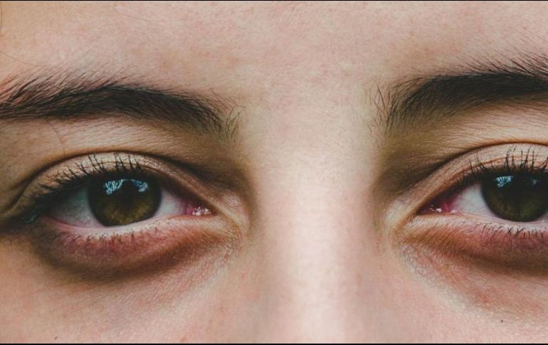 Hay diversos factores por los cuales aparecen las ojeras. ESPECIAL/Unsplash