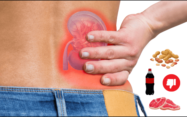 Limitar la ingesta de estos alimentos puede ayudar a mantener la salud renal. ESPECIAL / Prexels vía blueshot