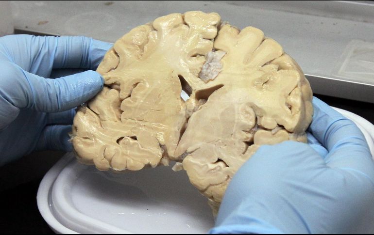 El estudio analiza las reacciones cerebrales ante diversos estímulos. NOTIMEX/ARCHIVO