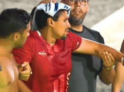 Pato Araujo sufrió un impactante golpe al colisionar con una barra de acero. /