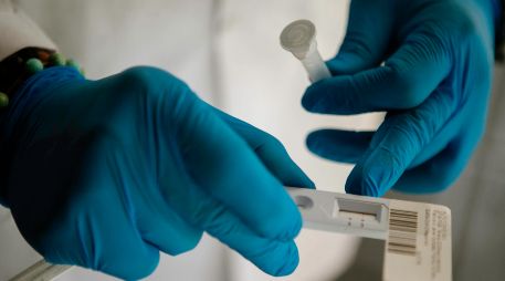 Decidieron enviar muestras al Centro para el Control y Prevención de Enfermedades de Estados Unidos. EL INFORMADOR/ARCHIVO