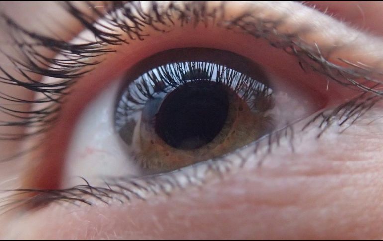 Realizar visitas regulares al oftalmólogo es fundamental para prevenir estas afecciones y asegurar una salud visual óptima. Pixabay