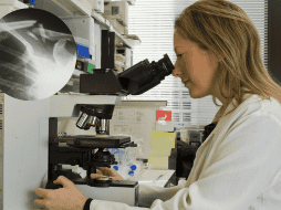 Las mujeres, corren un riesgo especialmente alto de osteoporosis después de la menopausia. UNSPLASH / NCI / H. RAETHEL