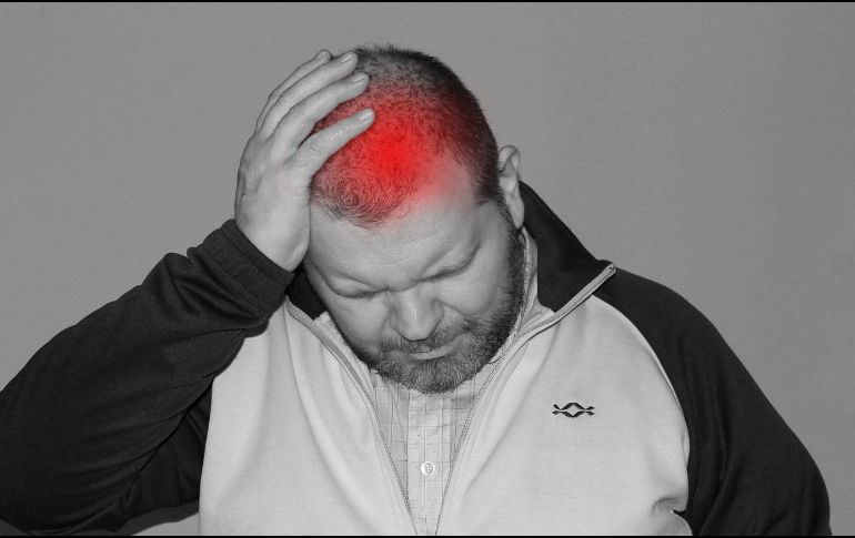 Los dolores de cabeza no controlados son una de las señales para acudir al neurólogo. ESPECIAL / Imagen de Tumisu en Pixabay