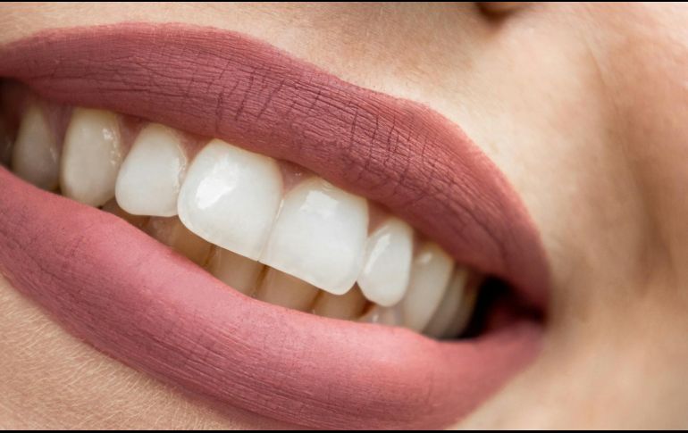 Usar pastas dentales no industriales son una excelente opción para las personas que sufren de padecimientos bucales, como la gingivitis. UNSPLASH/ Tony Litvyak