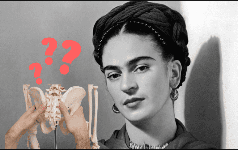  Frida Kahlo sufrió un accidente de autobús cuando tan sólo tenía 18 años, dejándole secuelas en su salud hasta el final de su vida. ESPECIAL/ CANVA
