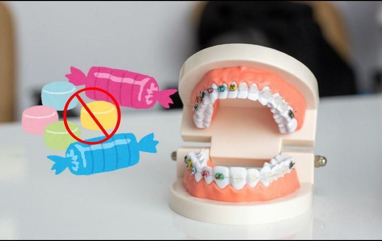 Cuida tus dientes y evita en medida de lo posible estos alimentos. UNSPLASH / E. YAVUZ