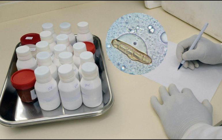 La Secretaría de Salud continúa trabajando en la vigilancia epidemiológica y en la implementación de medidas para evitar la propagación de la bacteria. ESPECIAL/Pexels