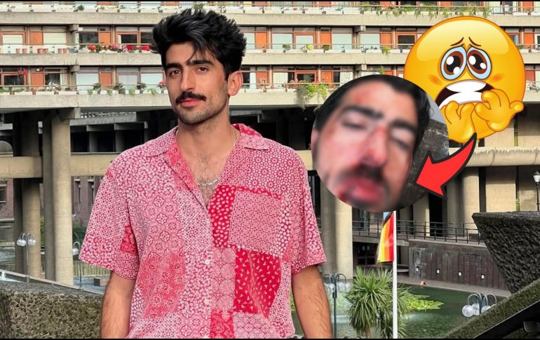 Muchos de sus seguidores consideran que la imagen podría tener múltiples interpretaciones, desde un efecto de maquillaje para alguna historia divertida hasta la posibilidad de una agresión real.  INSTAGRAM/jezzzini