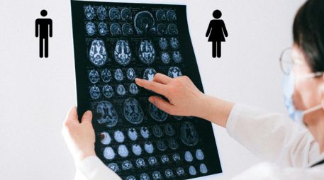 Las investigadoras sugieren que la expresión subclínica del riesgo genético de esquizofrenia podría diferir según el sexo. Pexels y Canva