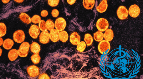 La variante menos letal de 2022 ya llevó a la OMS a una primera declaración de la emergencia sanitaria internacional. UNSPLASH / National Institute of Allergy and Infectious Diseases