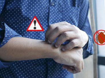 Si tienes chinches en casa, lo más recomendable para su exterminio es acudir con profesionales. Pexels y Canva