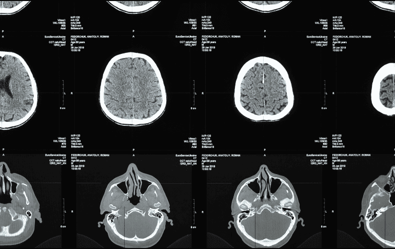 Investigaciones recientes señalan que el entrenamiento de fuerza no solo fortalece los músculos, sino que también beneficia la salud cerebral. Canva / O. Fedorchuk
