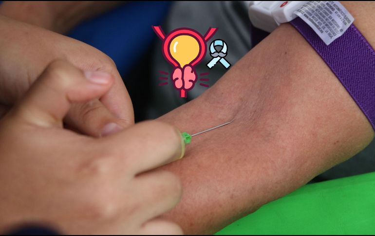 Esto es todo lo que debes de saber acerca del cáncer de próstata. EL INFORMADOR / ARCHIVO