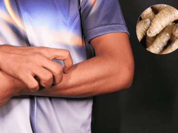 El primer caso humano fue confirmado el pasado 6 de febrero en un hombre de 80 años. ESPECIAL