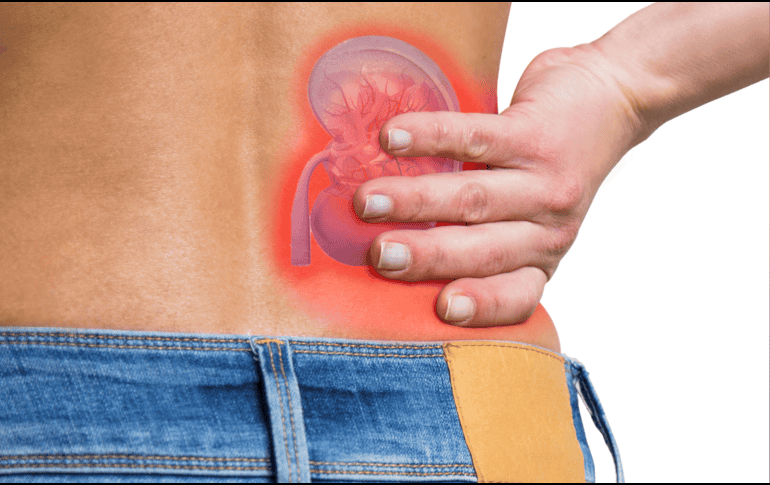 El IMSS hace un llamado a los derechohabientes a cuidar de su salud renal mediante acciones preventivas como tener una buena alimentación. ESPECIAL / CANVA