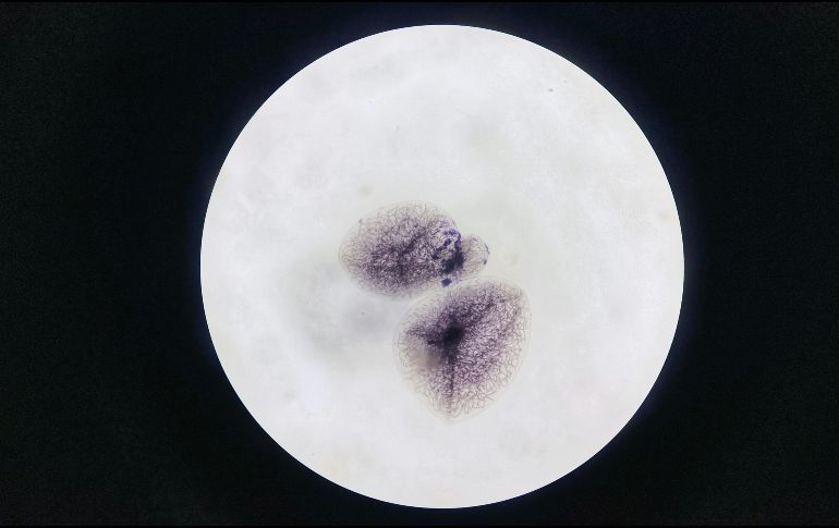 El hallazgo también replantea la necesidad de conocer con más detalle la población de bacterias que pueden colonizar el útero. UNSPLASH / C. Qi Huang