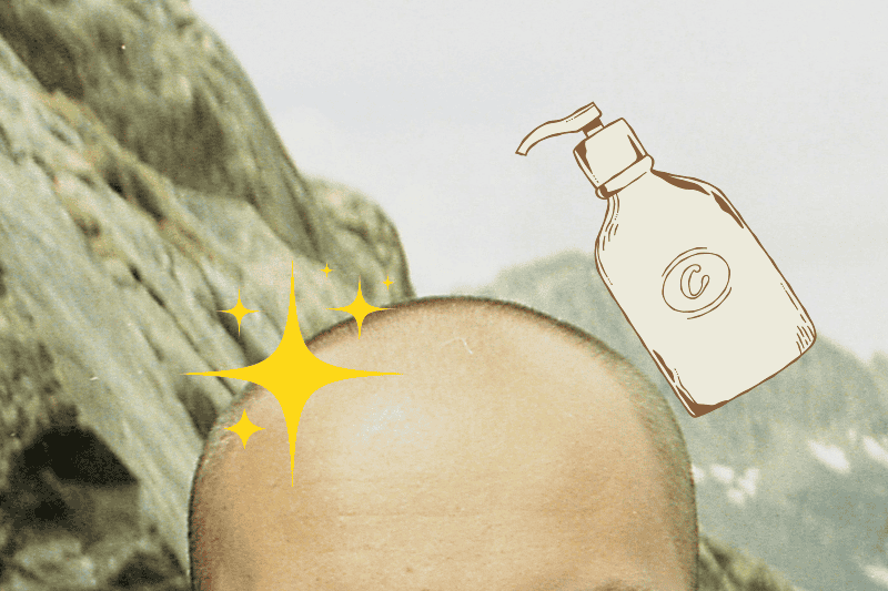 La alopecia implica perder el pelo, quedarse calvo; otra cosa es la caída, que puede ser estacional, en la que se está renovando el cabello. UNSPLASH / M. Moloney 