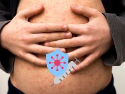 El sarampión es una enfermedad prevenible mediante la aplicación de una vacuna. ESPECIAL / CANVA