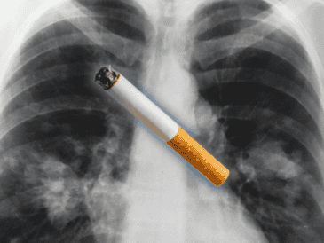 El análisis se basó en 871 muestras de tumores de pulmón de personas no fumadoras residentes en 28 regiones del mundo —incluyendo África, Asia, Europa y América del Norte— con diferentes niveles de contaminación del aire. ESPECIAL / Canva