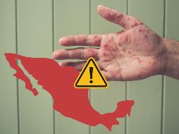 La mayoría de los contagios del brote de sarampión en México, se han presentado en Chihuahua. ESPECIAL / CANVA