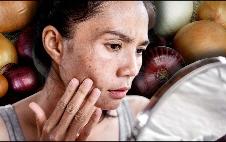 La cebolla, más allá de ser un básico culinario, es un ingrediente con propiedades dermatológicas prometedoras. CANVA