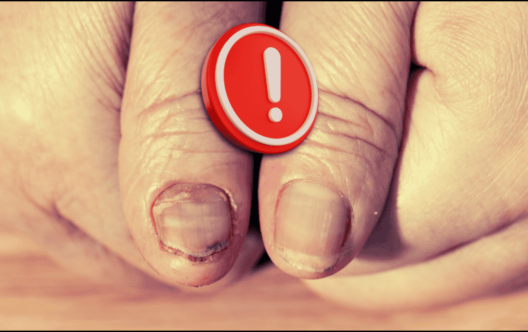 La detección temprana y el tratamiento oportuno son clave para mejorar la supervivencia y calidad de vida de los pacientes. ESPECIAL / CANVA