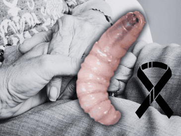 Por la infección de gusano barrenador, la adulta mayor recibió tratamiento. ESPECIAL