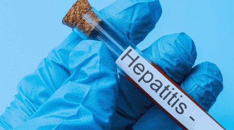 La hepatitis se clasifica en cuatro diferentes tipos, tanto por sus consecuencias, algunas más graves que otras y la forma en que una persona se contagia. ESPECIAL / Canva