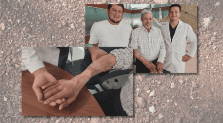 El paciente acudió al servicio de Urgencias del Seguro Social con más de 48 horas de evolución, pero al final el resultado fue positivo. ESPECIAL / IMSS