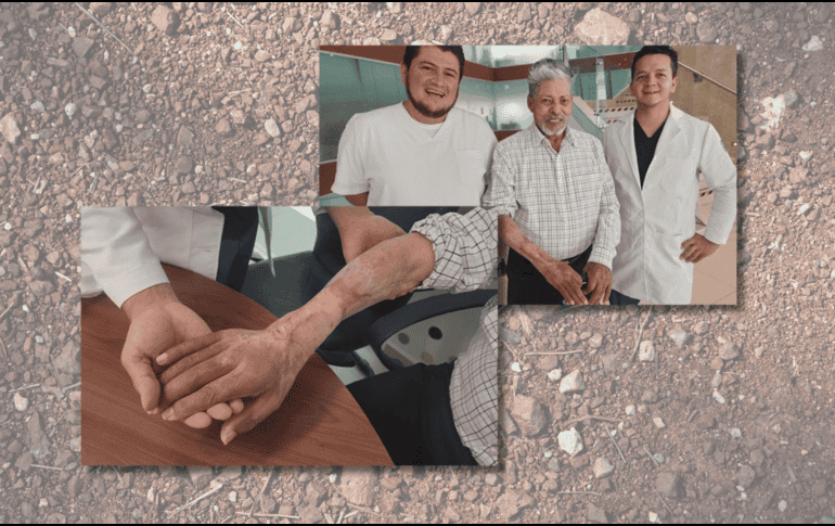 El paciente acudió al servicio de Urgencias del Seguro Social con más de 48 horas de evolución, pero al final el resultado fue positivo. ESPECIAL / IMSS