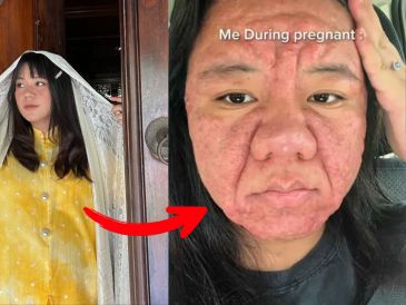 Este caso no solo ha captado la atención por lo llamativo de las imágenes, sino que también ha puesto sobre la mesa una conversación poco abordada sobre las realidades menos visibles del embarazo. INSTAGRAM/@farahf4izal