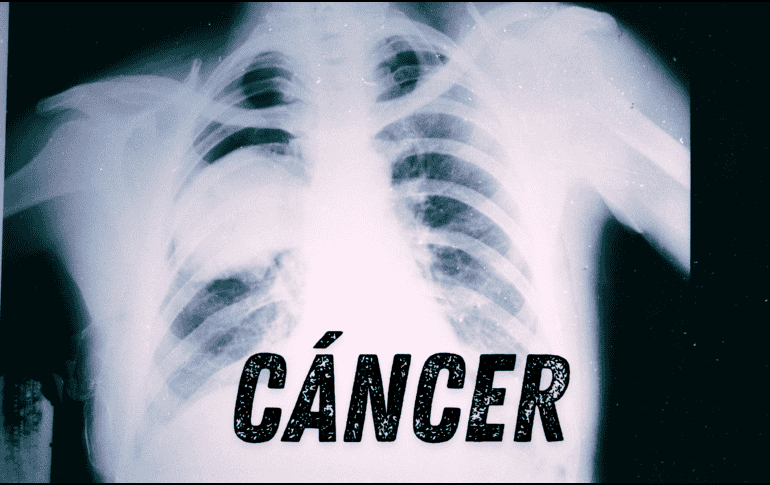 Los pacientes exfumadores tenían un 60% más de riesgo de desarrollar una segunda neoplasia y los que seguían fumando también mostraron un incremento de riesgo 