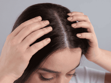 El cuero cabelludo sin cabello está directamente expuesto al sol, por lo que requiere el mismo nivel de protección que el rostro. CANVA