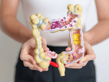 Los especialistas recomiendan no suspender ni evitar los tratamientos antibióticos cuando son prescritos por un médico, pero sí enfatizan la importancia de evitar su uso innecesario. CANVA