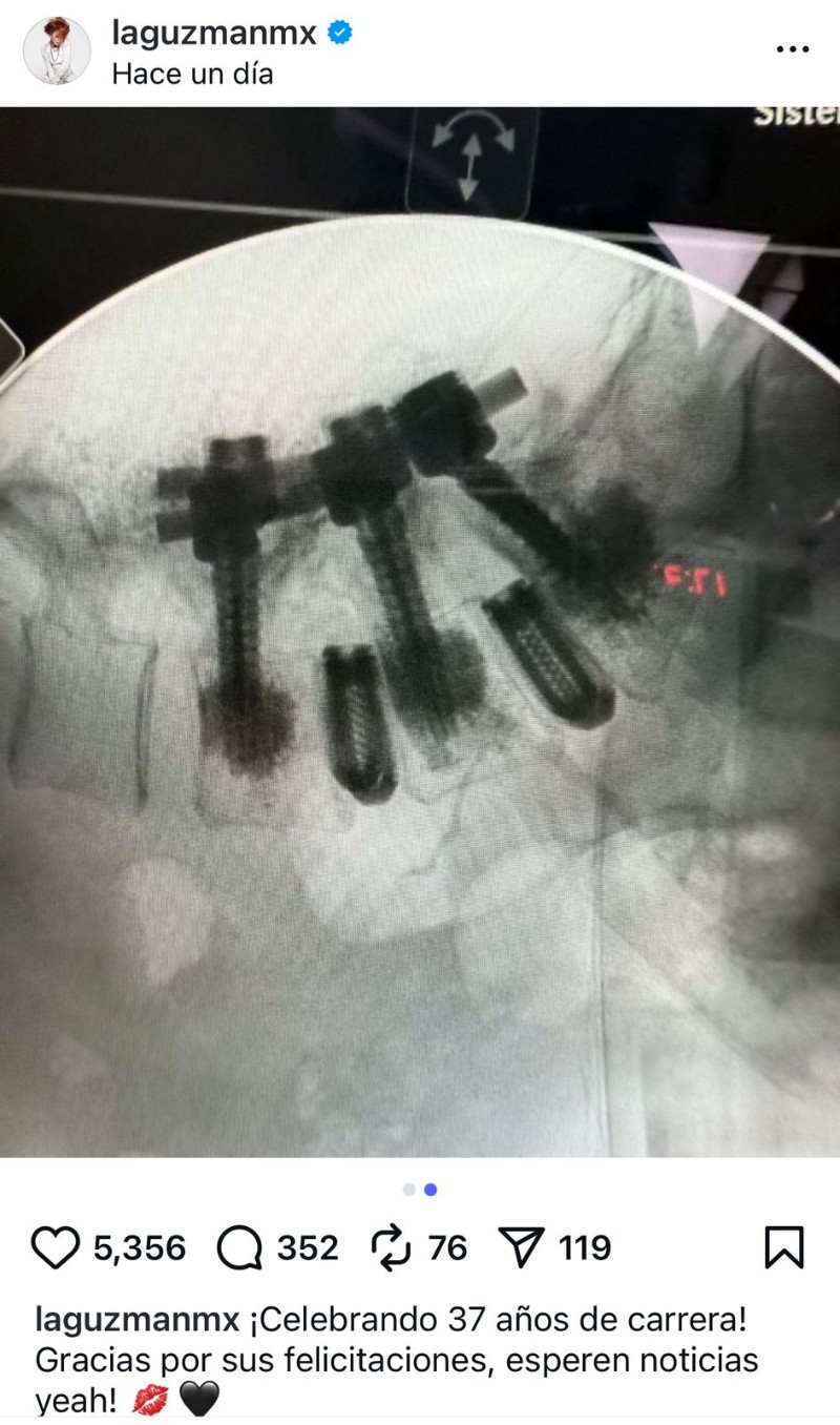  ESPECIAL / IG / @laguzmanmx