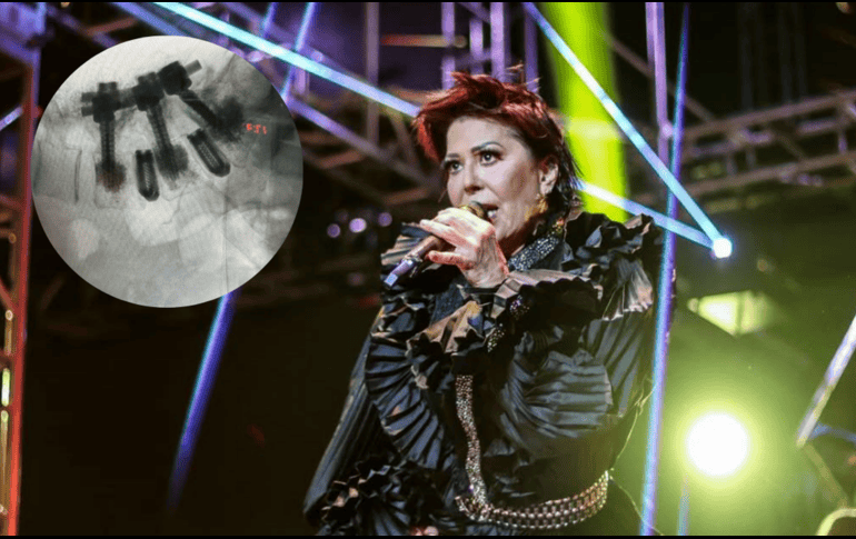 Alejandra Guzmán reaparece tras cirugía de columna. ESPECIAL / IG / @laguzmanmx