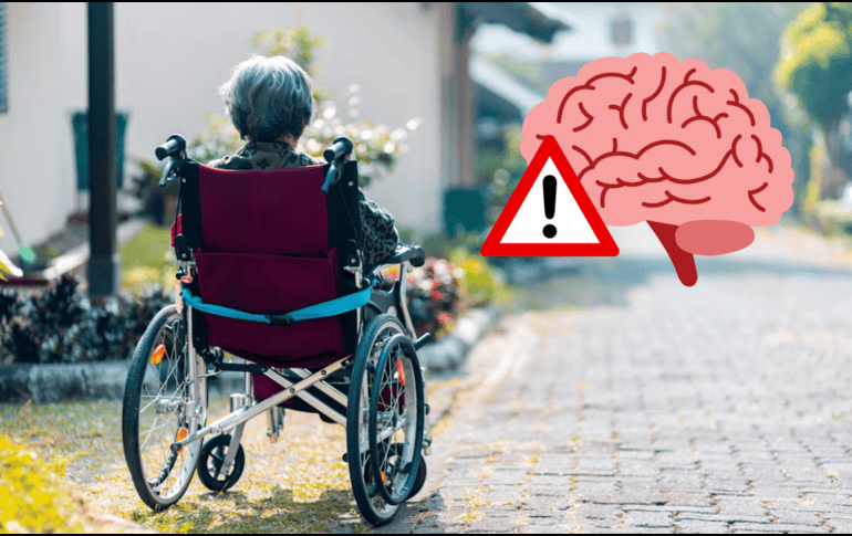 Descubre cómo actuar ante un derrame cerebral. UNSPLASH / STEVEN HWG